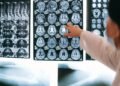 Radiologist pointing at brain MRI scans showing detailed medical examination.