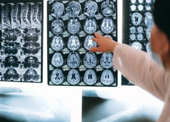 Radiologist pointing at brain MRI scans showing detailed medical examination.