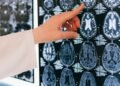 finger pointing to a brain scan
