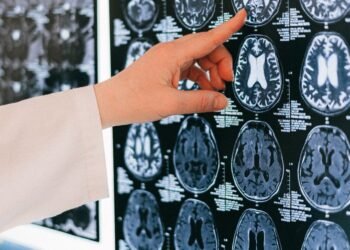 finger pointing to a brain scan