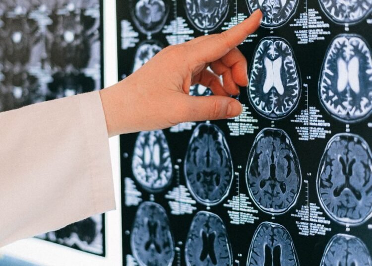 finger pointing to a brain scan